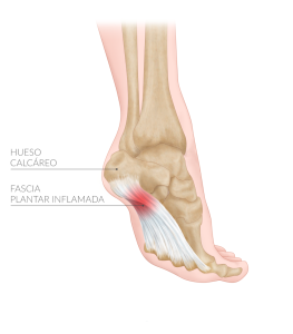 diagrama. ilustración científica. infografia. ilustracion médica. NorArte Visual Science